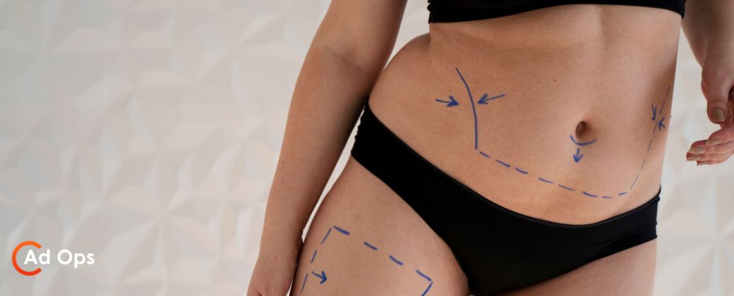 מה עוד אפשרויות שאיבת שומן מלבד לייזר ובצד שמאל למטה לוגו אתר adops