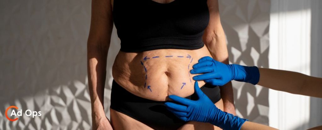 מה עוד אפשרויות שאיבת שומן מלבד לייזר ובצד למטה לוגו אתר ADOPS